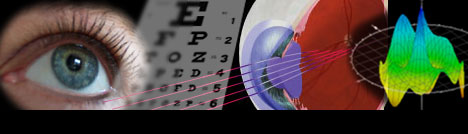 Tracey Technologies and wavefront aberrometry for your vision